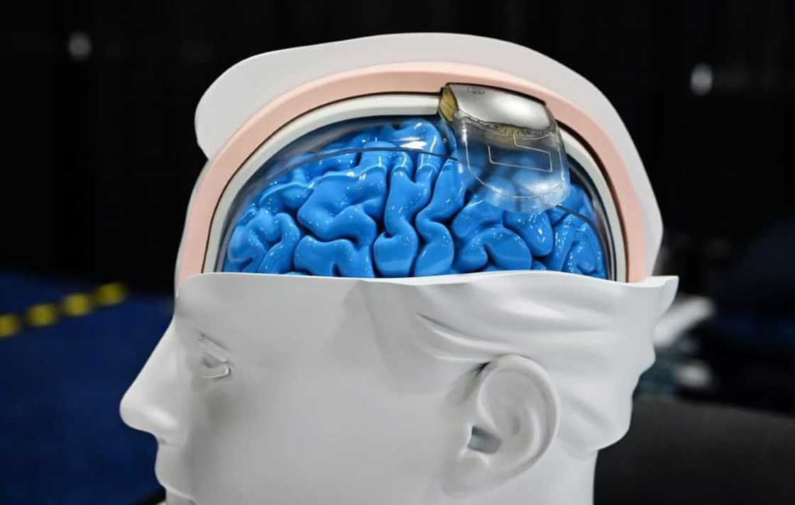 The Wimagine implant on display ahead of CES in Las Vegas on January 7, 2024 The Wimagine implant on display ahead of CES in Las Vegas on January 7, 2024