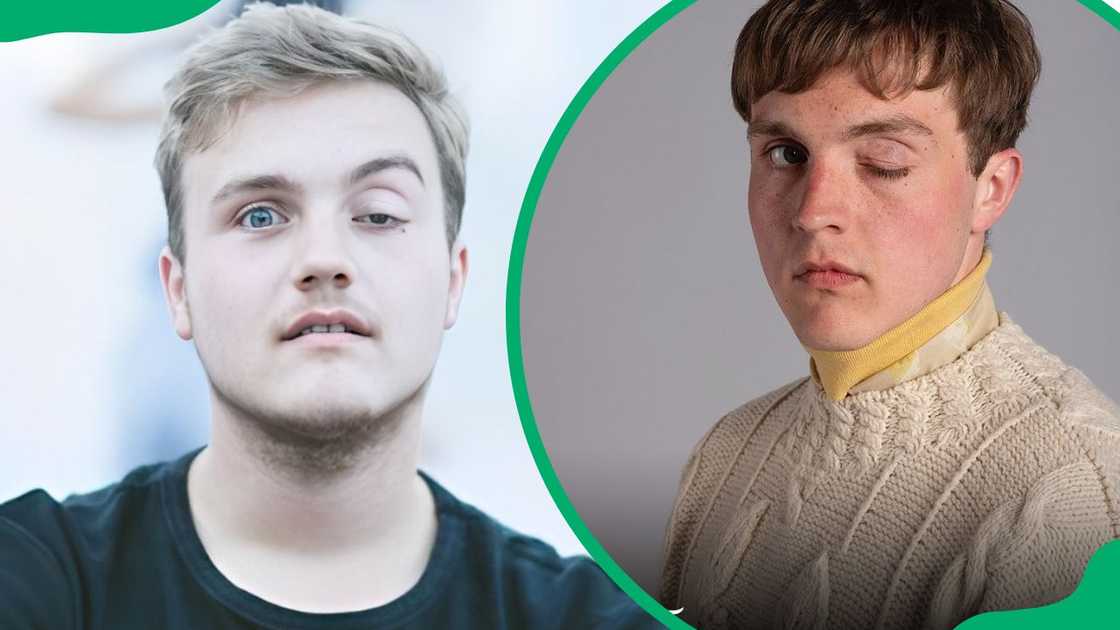 A before and after photo of Kjell Brutscheidt’s left eye A before and after photo of Kjell Brutscheidt’s left eye