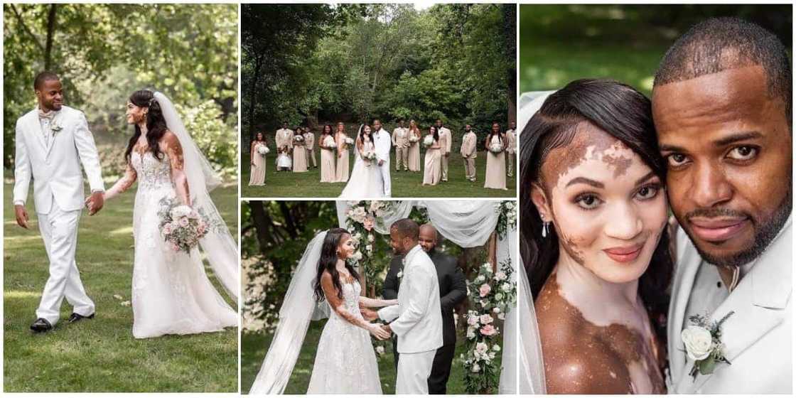 Beautiful photos of a wedding involving a man and his vitiligo lover
Photo Credit: @pass_man