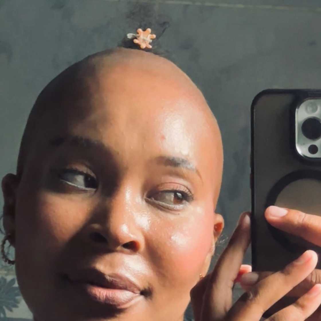 Social media users gave a woman hair advice after watching her hair falling out in a video Social media users gave a woman hair advice after watching her hair falling out in a video