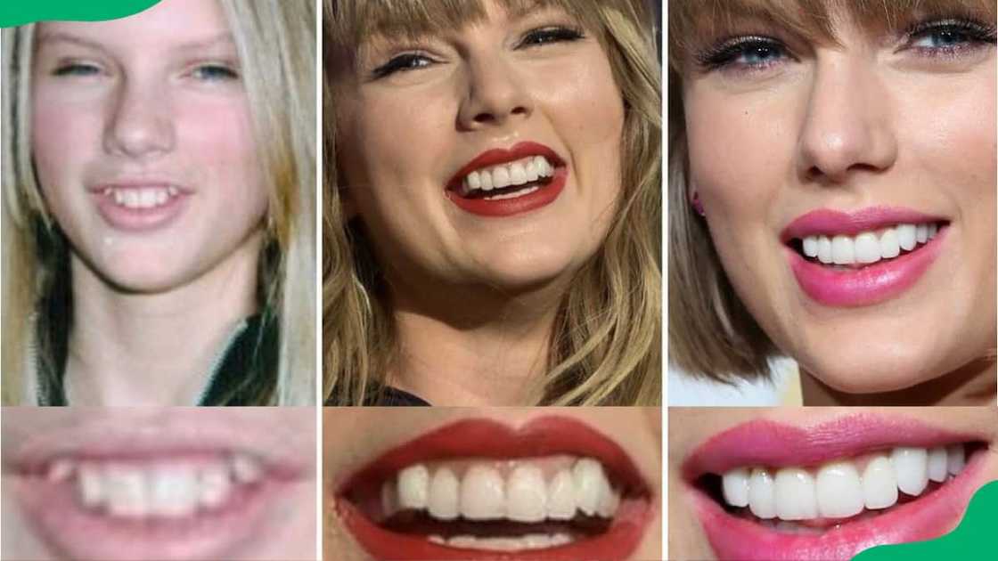 Taylor Swift's teeth transformation