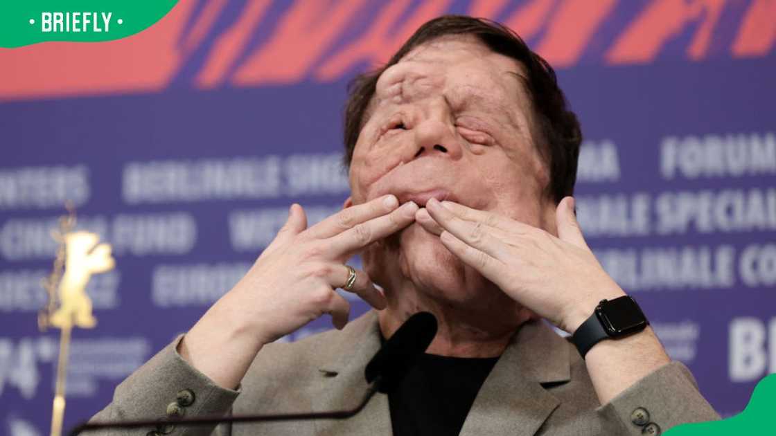 Adam Pearson during the 2024 Berlinale International Film Festival at the Grand Hyatt Hotel Adam Pearson during the 2024 Berlinale International Film Festival at the Grand Hyatt Hotel