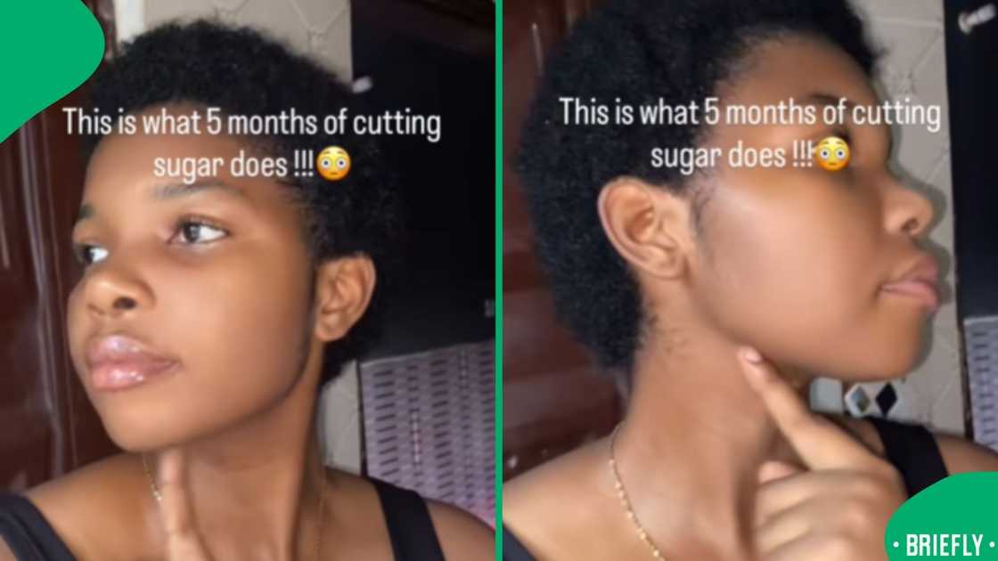 AJ showed her skin after cutting sugar from her diet AJ showed her skin after cutting sugar from her diet