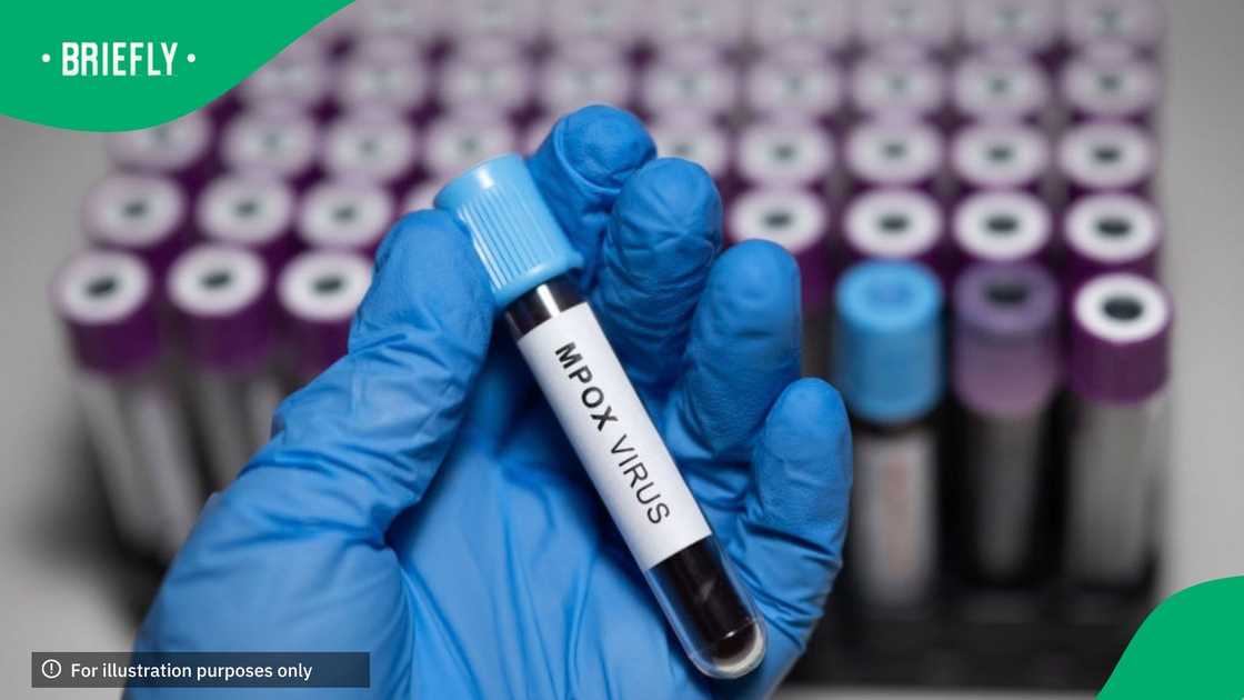 A Monkeypox (Mpox) blood test tube is seen among other blood test tubes in Ankara, Turkiye on August 28, 2024