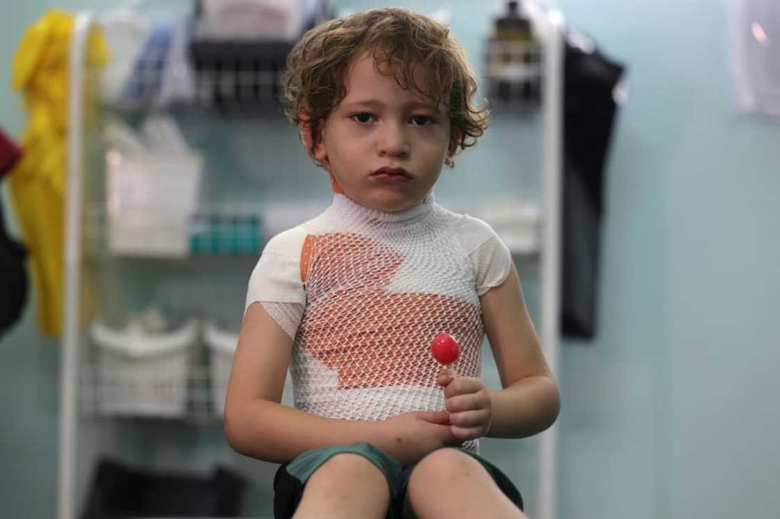 More than a third of the burns patients treated at MSF clinics across Gaza were aged under five More than a third of the burns patients treated at MSF clinics across Gaza were aged under five