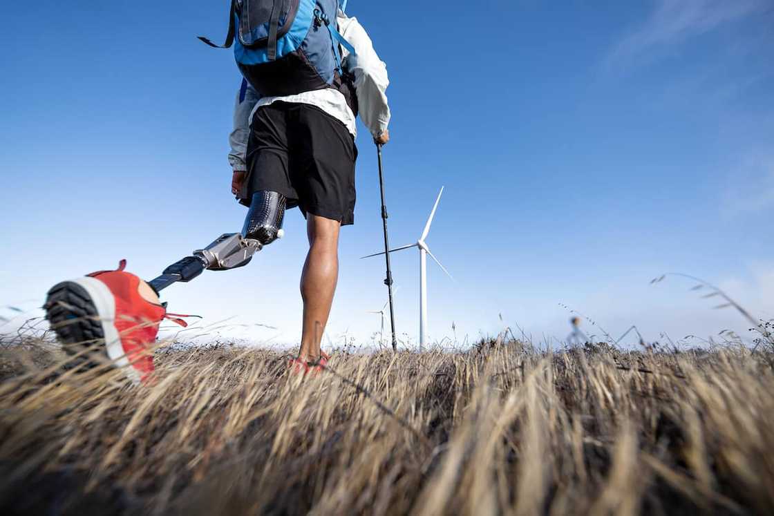 Prosthetic leg price in South Africa Prosthetic leg price in South Africa