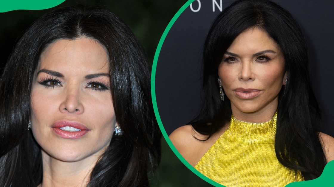 Lauren Sánchez's cheek and lip filler Lauren Sánchez's cheek and lip filler
