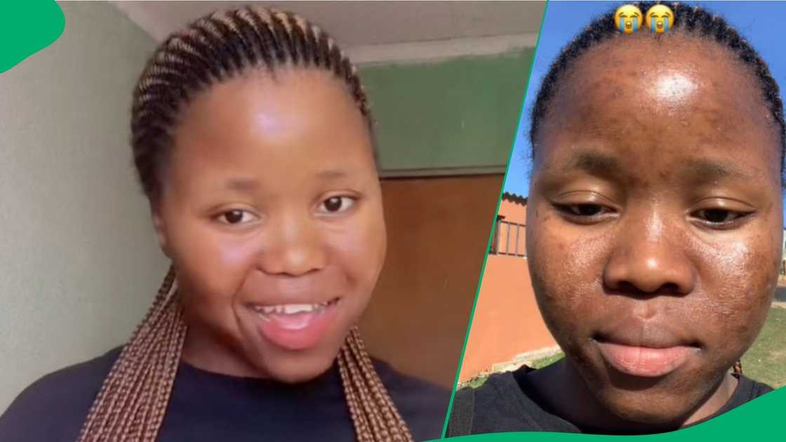 Woman's skin reacts badly to cheap skincare Woman's skin reacts badly to cheap skincare