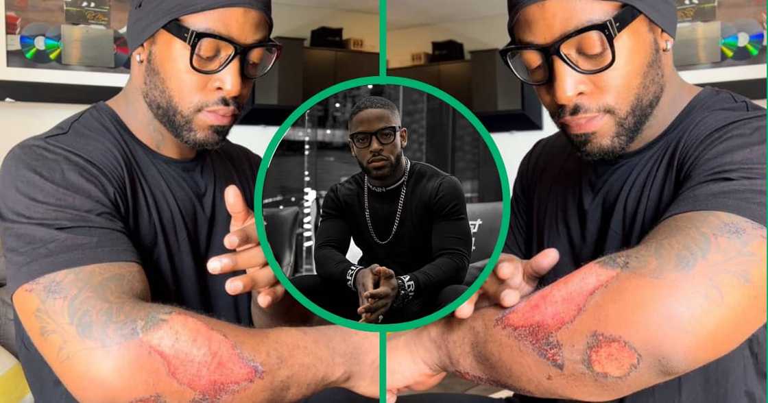 Prince Kaybee shared snapshots of his injured arm