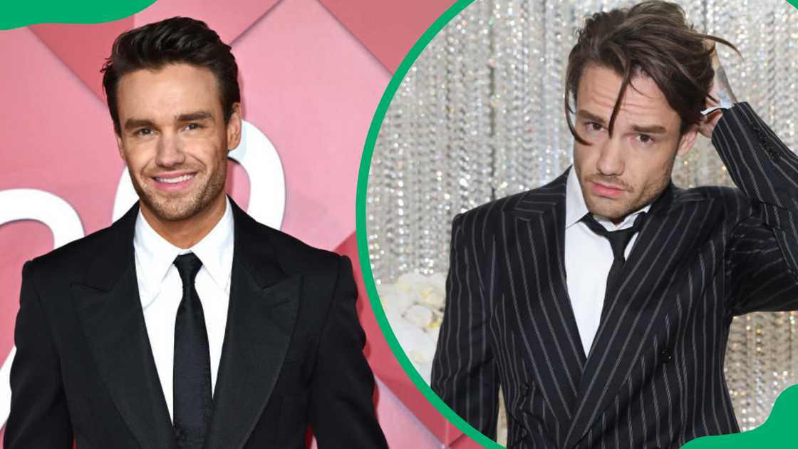 Liam Payne's plastic surgery Liam Payne's plastic surgery