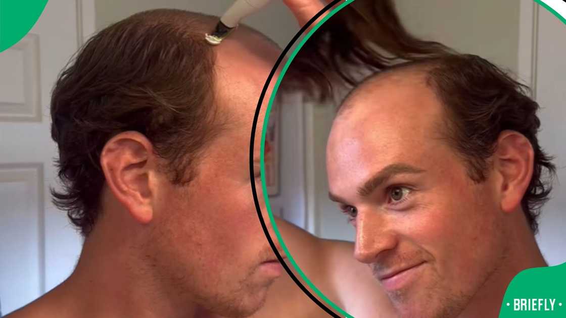 Balding man goes viral Balding man goes viral