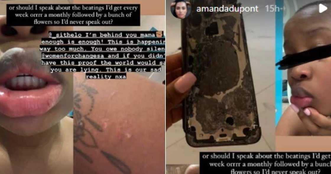 Sithelo Shozi, injuries, gbv, Amanda du-Pont Sithelo Shozi, injuries, gbv, Amanda du-Pont