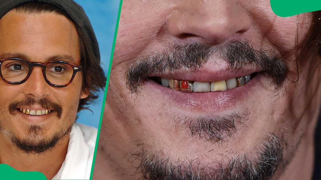 Johnny Depp's teeth