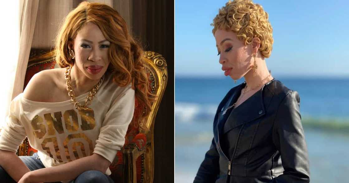 Refilwe Modiselle Does Not Want to Be Called "Albino", Calls It Derogatory Refilwe Modiselle Does Not Want to Be Called "Albino", Calls It Derogatory
