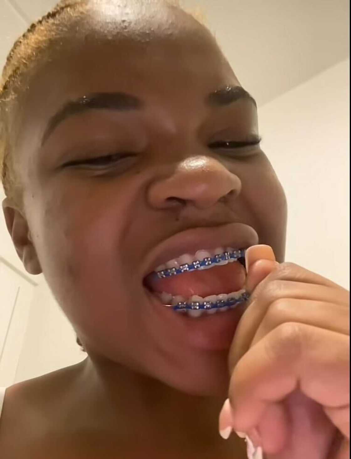 A young South African woman shared how her braces prank ended in disaster.
