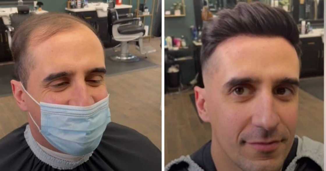 baldness, viral video, hair, technology baldness, viral video, hair, technology