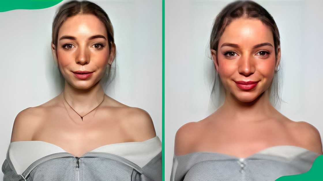 Barbie Botox before and after