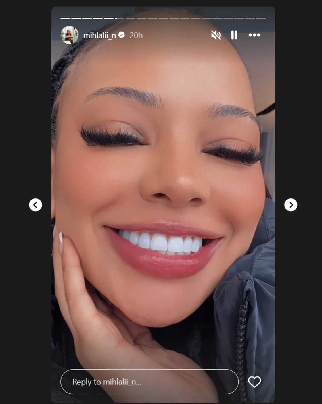 Mihlali Ndamase got new veneers.