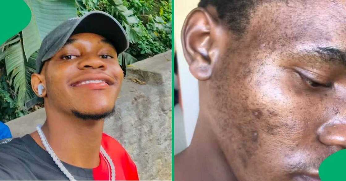 A TikTok video shows a man unveiling products that he uses to clear up his skin from dark spots.