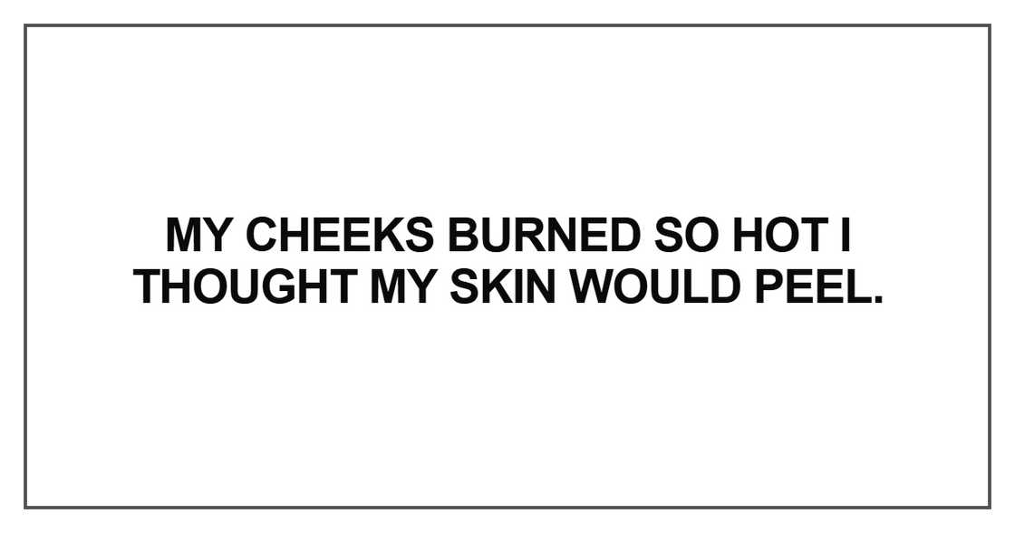 My cheeks burned so hot I thought my skin would peel My cheeks burned so hot I thought my skin would peel