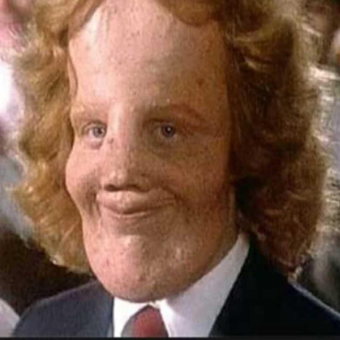 Rocky Dennis Rocky Dennis