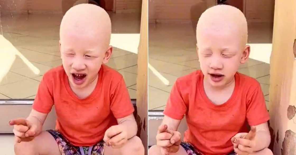 Boy with albinism opens up Boy with albinism opens up
