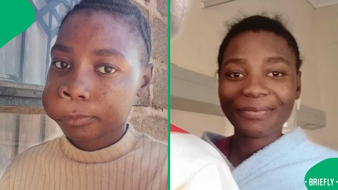 A 19-year-old teenager had to put her dreams of pursing her tertiary studies on hold due to a facial growth A 19-year-old teenager had to put her dreams of pursing her tertiary studies on hold due to a facial growth