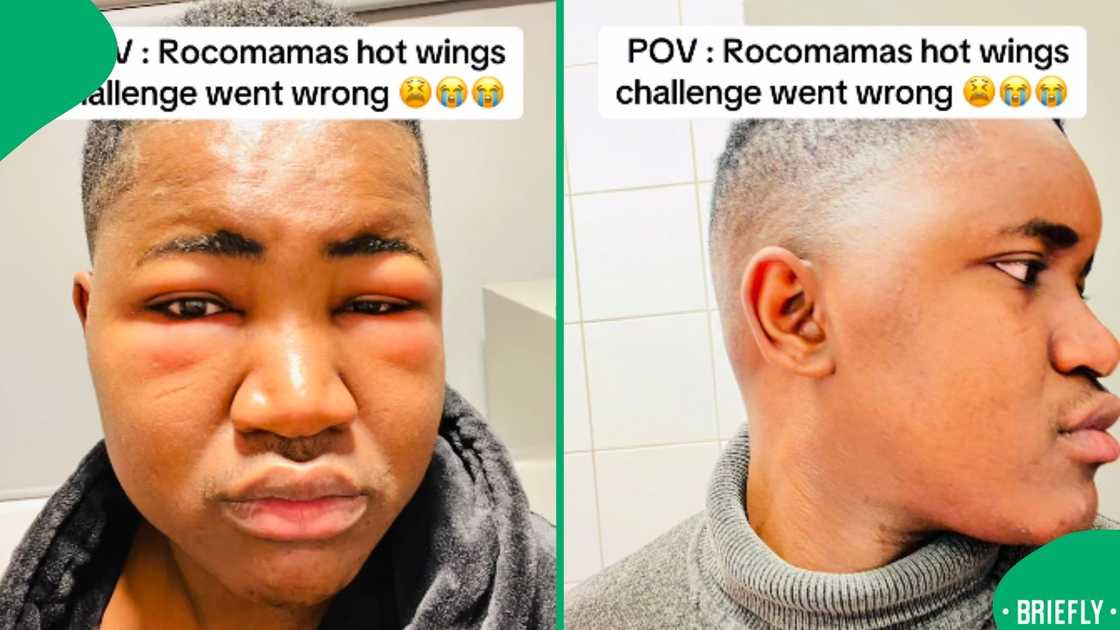 Ronewa on the right did a side view of his swollen head