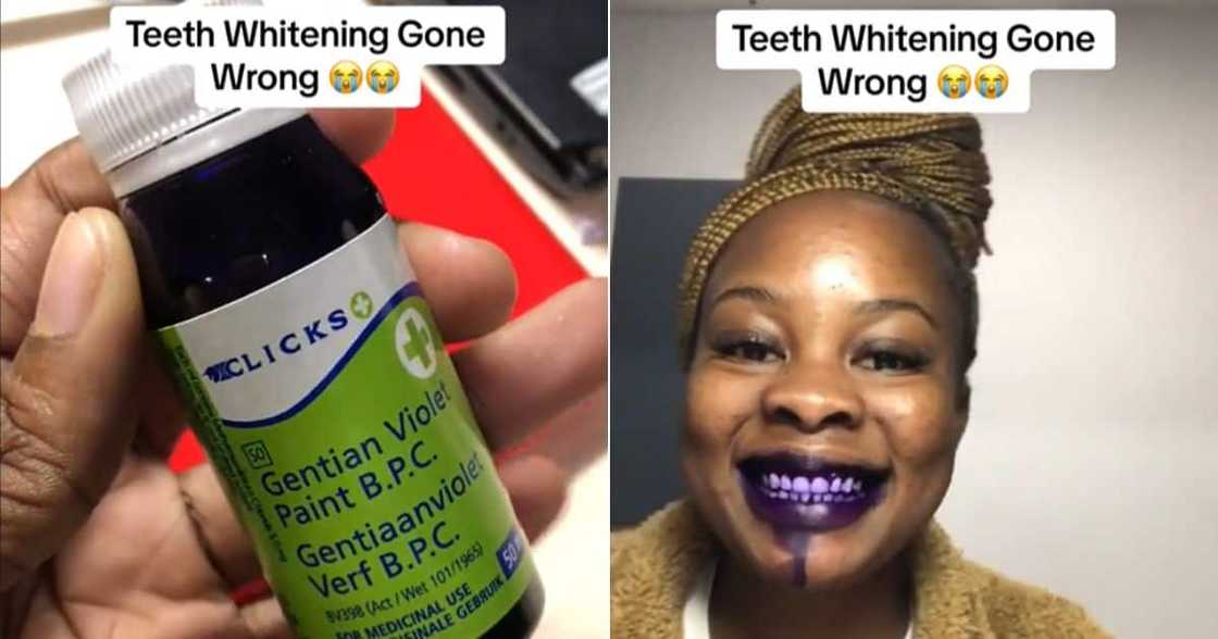 Friend whitens teeth with gentian violet in TikTok video