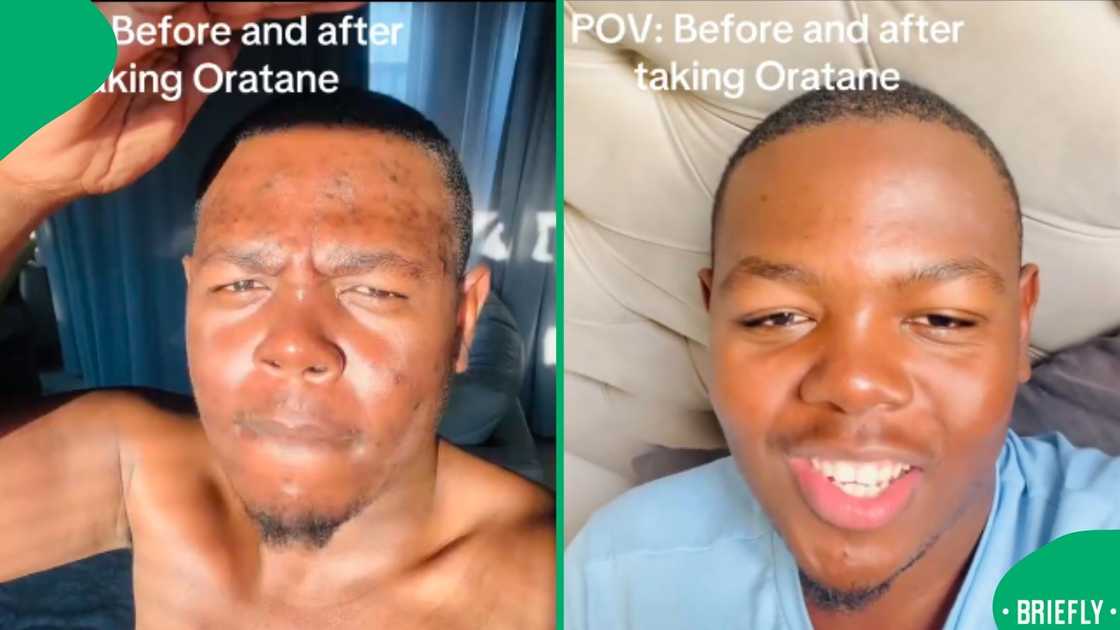A South African TikTok user shared his 7-month skincare journey using just one product, and the transformation was stunning