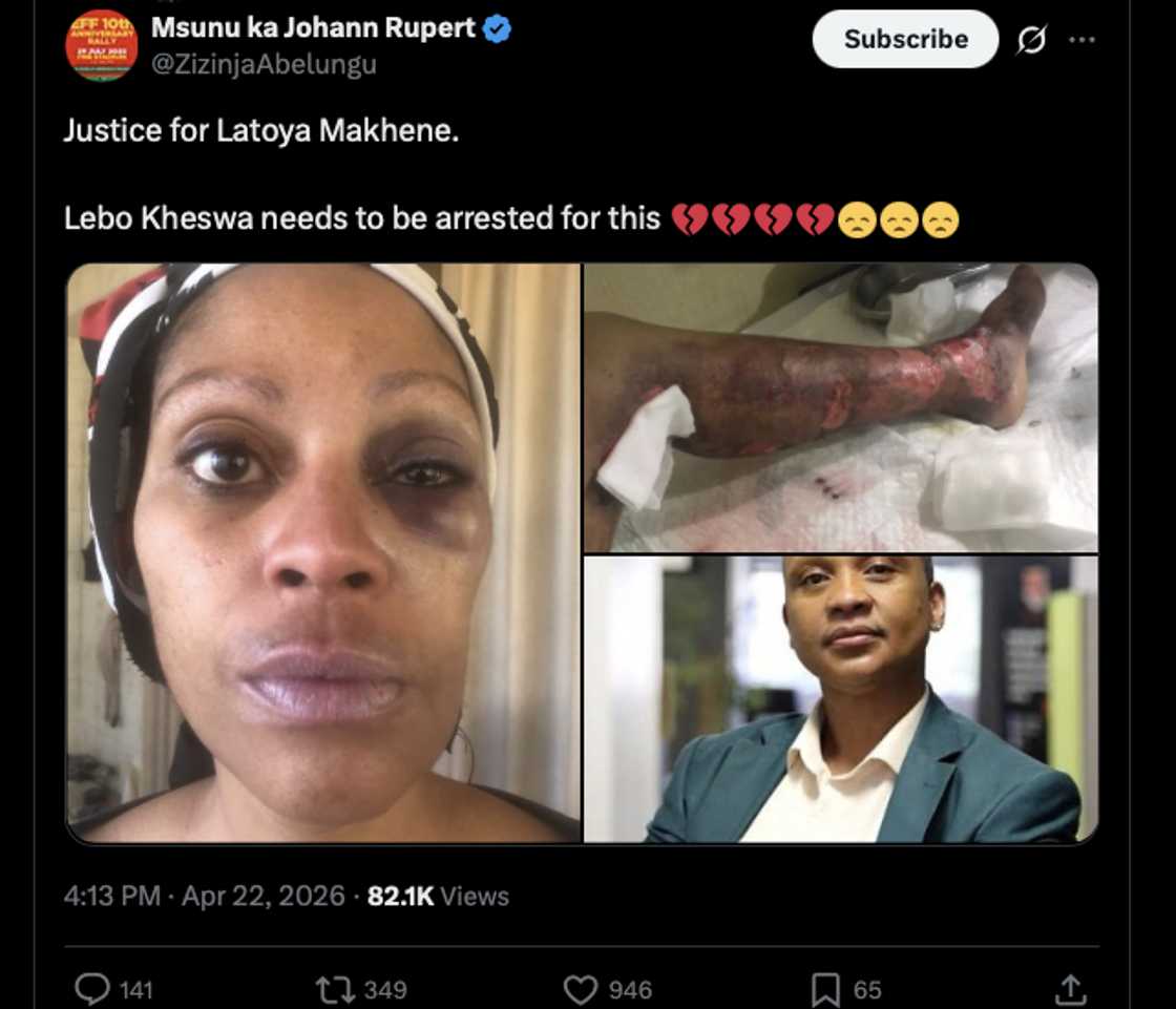 Lebo Keswa allegedly abused Letoya Makhene Lebo Keswa allegedly abused Letoya Makhene