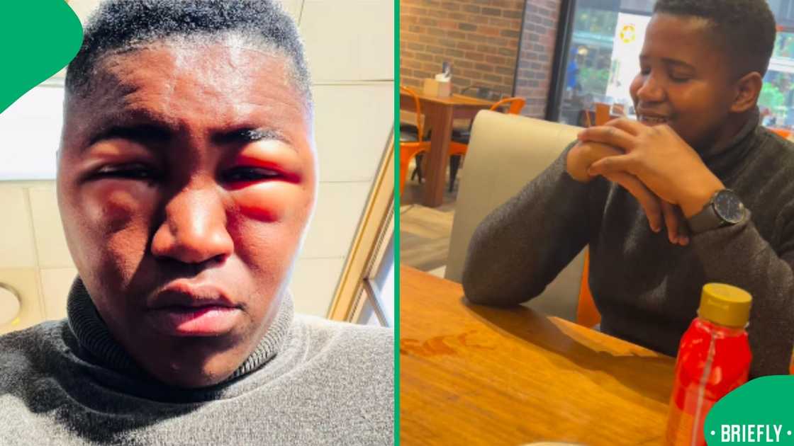Ronewa on the left, had swollen eyes and face