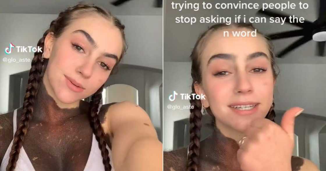 Lady with birthmark goes viral Lady with birthmark goes viral