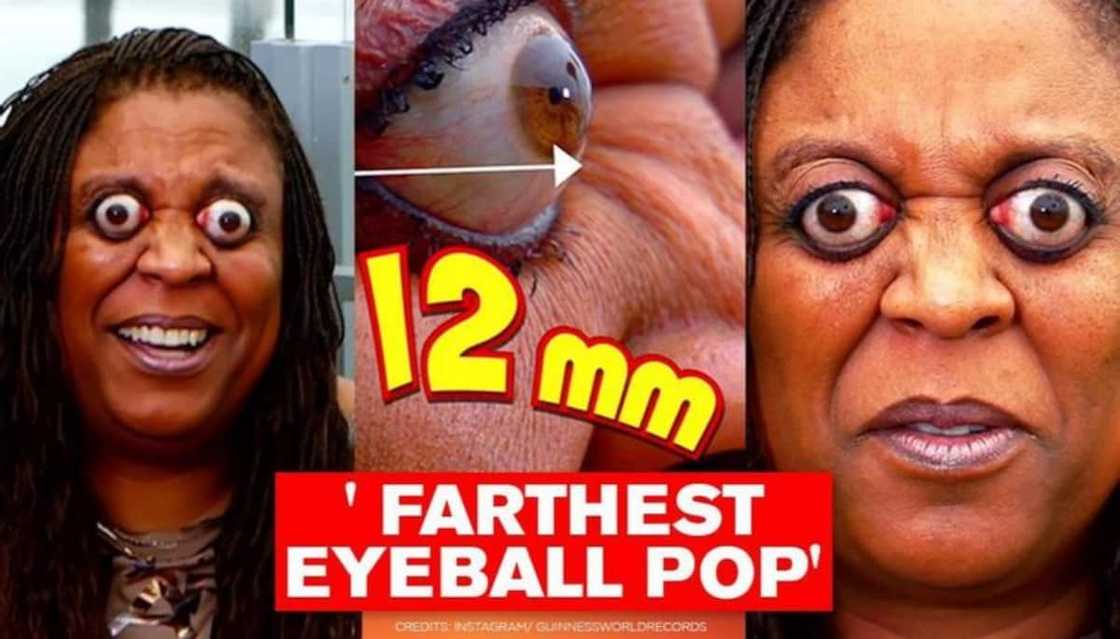 Kim goodman: Interesting life story of the lady with the farthest eye popper Kim goodman: Interesting life story of the lady with the farthest eye popper