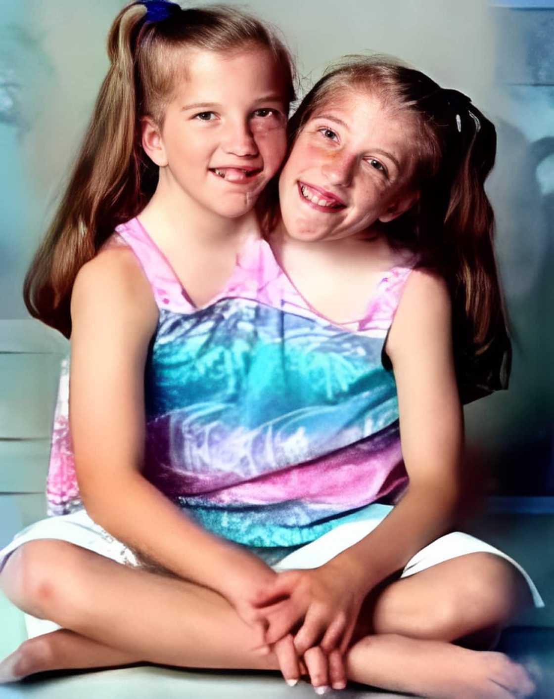conjoined twins Abby and Brittany Hensel conjoined twins Abby and Brittany Hensel