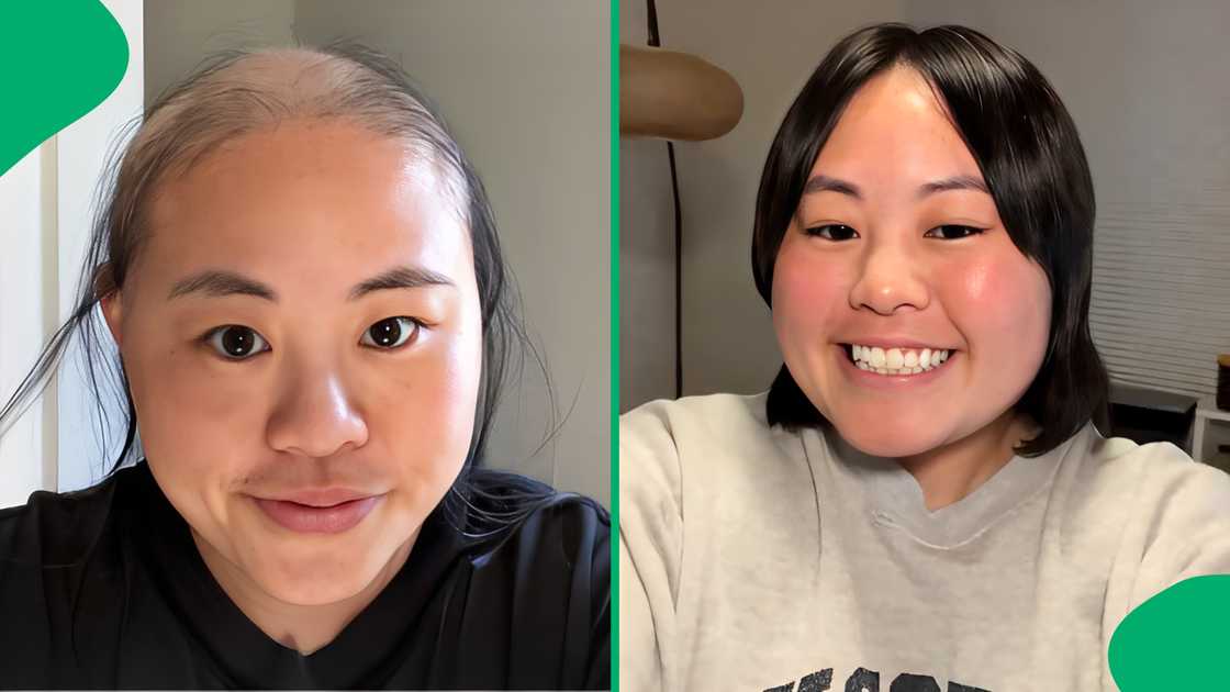 After studying engineering for 5 years, a lady shared how it made her almost completely bald. After studying engineering for 5 years, a lady shared how it made her almost completely bald.