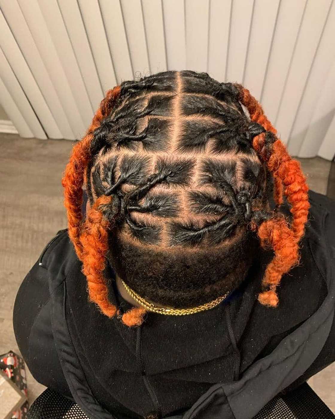 Can dreadlocks be undone?