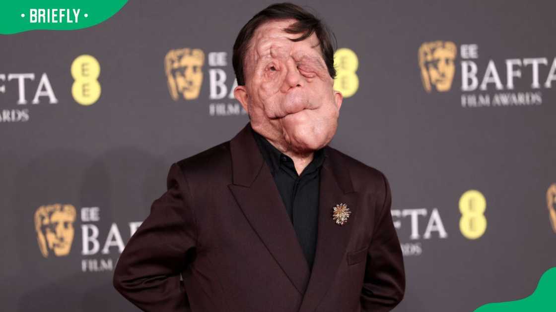 On-screen star Adam Pearson during the 2025 EE BAFTA Film Awards at The Royal Festival Hall On-screen star Adam Pearson during the 2025 EE BAFTA Film Awards at The Royal Festival Hall