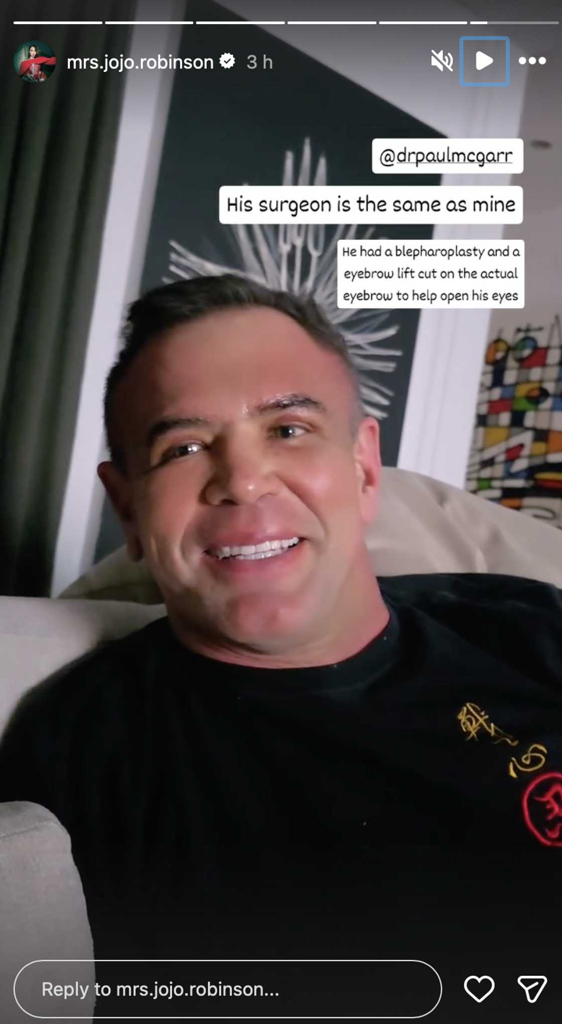 Jojo Robinson's husband underwent cosmetic eyelid surgery Jojo Robinson's husband underwent cosmetic eyelid surgery