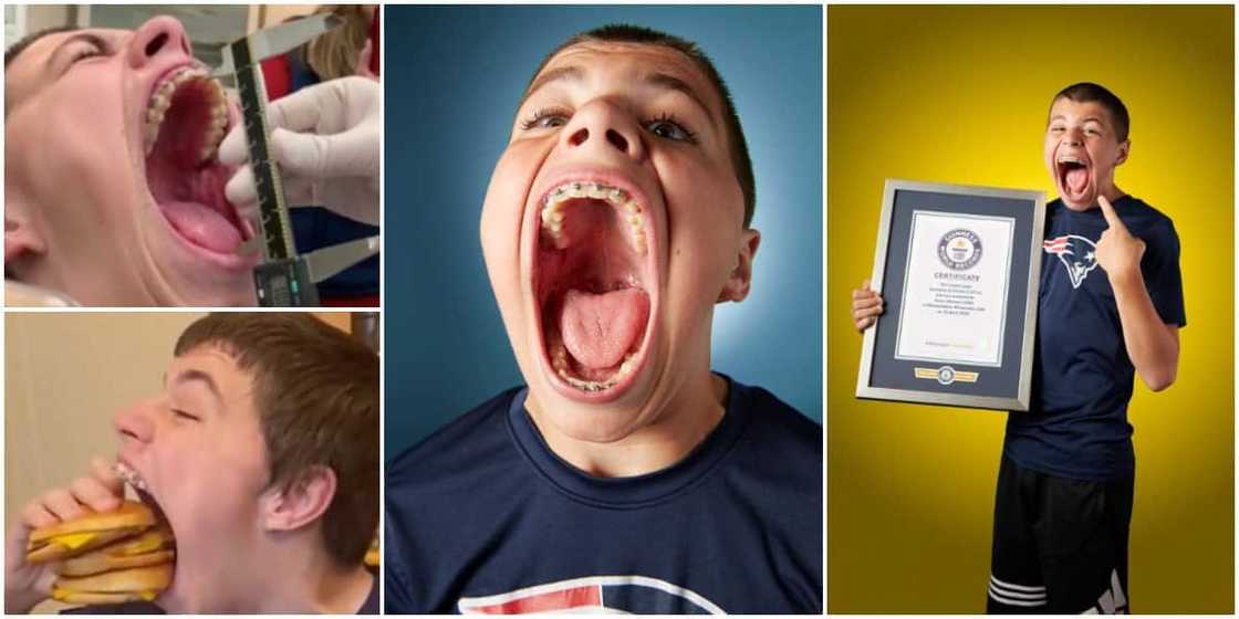 Teenage, boy, Guinness World Record, widest mouth Teenage, boy, Guinness World Record, widest mouth