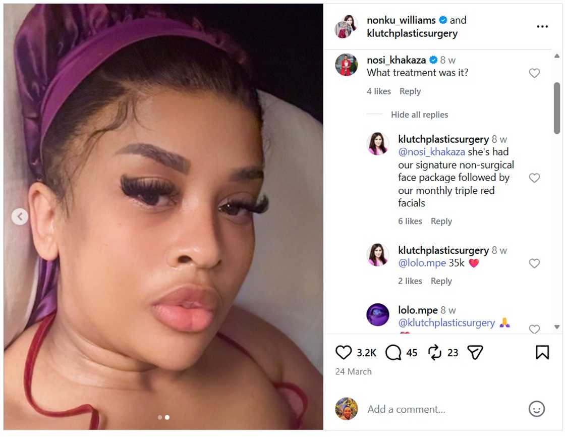 Nonku Williams shares anti-ageing beauty procedure Nonku Williams shares anti-ageing beauty procedure