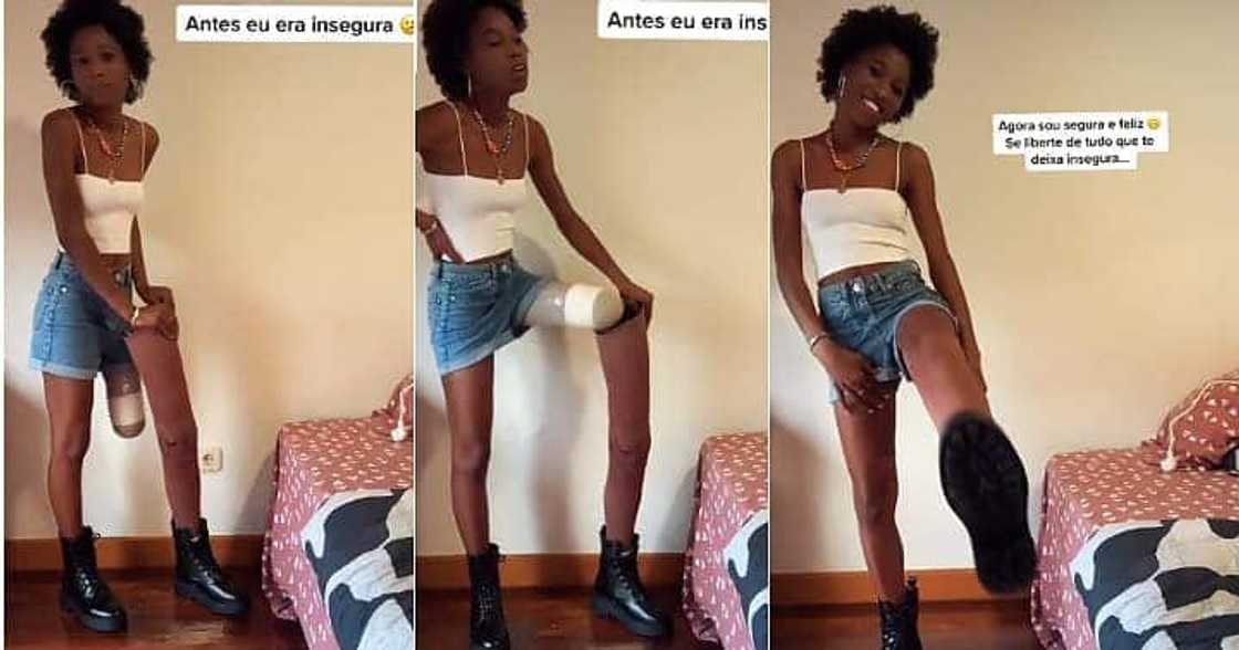 Beautiful lady flaunts artificial leg, positivity