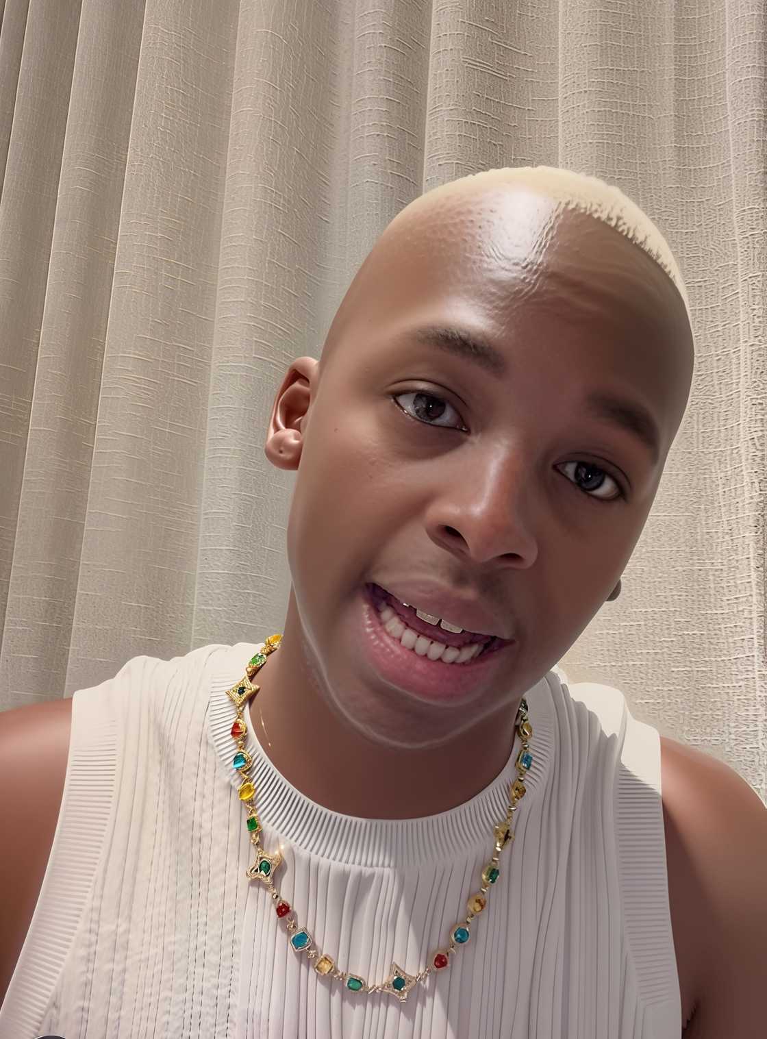 Ciza talked about growing up with 12 fingers Ciza talked about growing up with 12 fingers