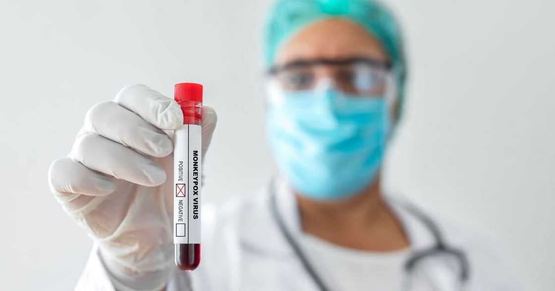 1st, case, Monkeypox, Limpopo, tourist, Switzerland, 42-year-old, man 1st, case, Monkeypox, Limpopo, tourist, Switzerland, 42-year-old, man