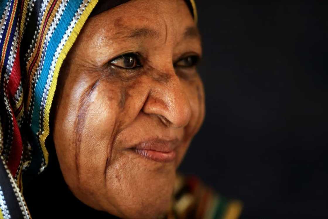 Tribal scarring, an ancient practice that used to be commonplace, involves marking the skin, mainly to identify tribal affiliation or as a symbol of attractiveness Tribal scarring, an ancient practice that used to be commonplace, involves marking the skin, mainly to identify tribal affiliation or as a symbol of attractiveness