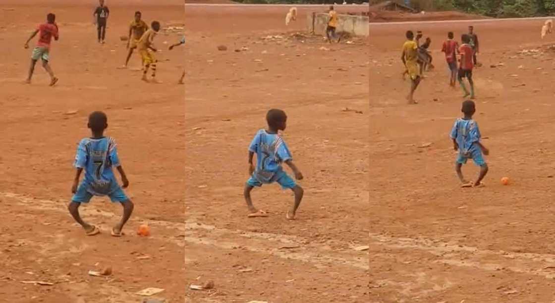 Photos of a boy with bowel legs