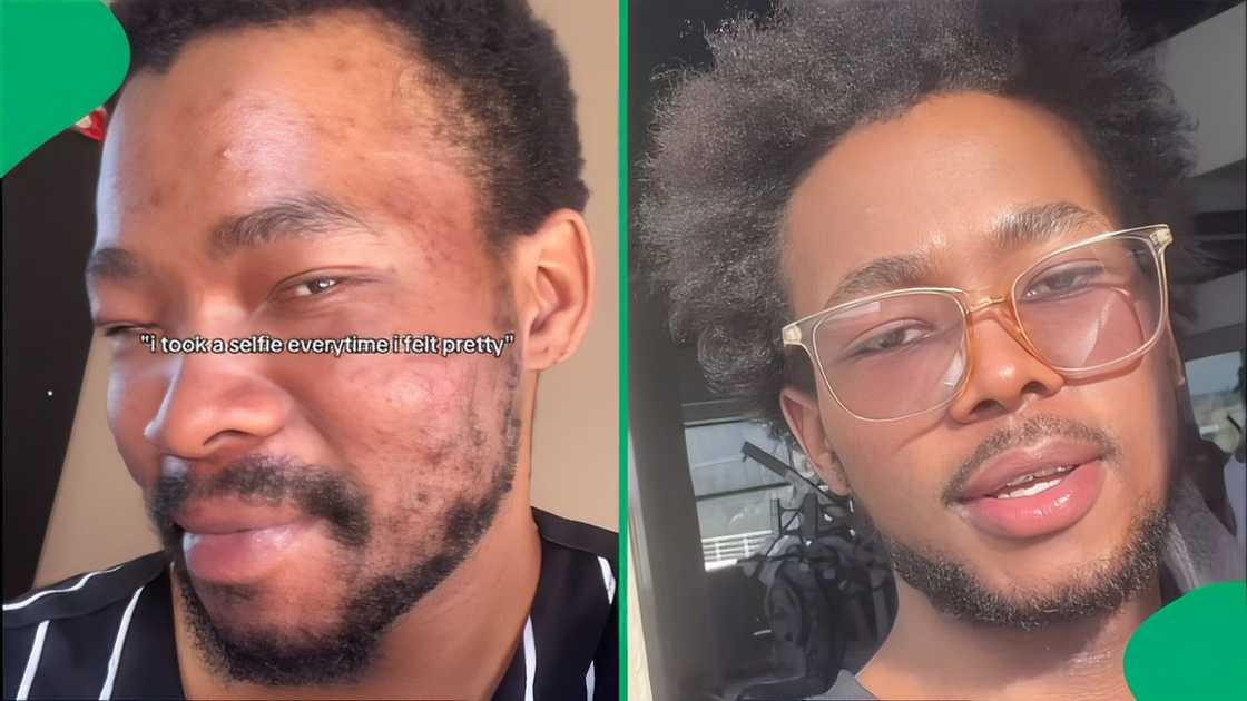 A man took to TikTok to showcase his skin glow-up, and people were shocked.