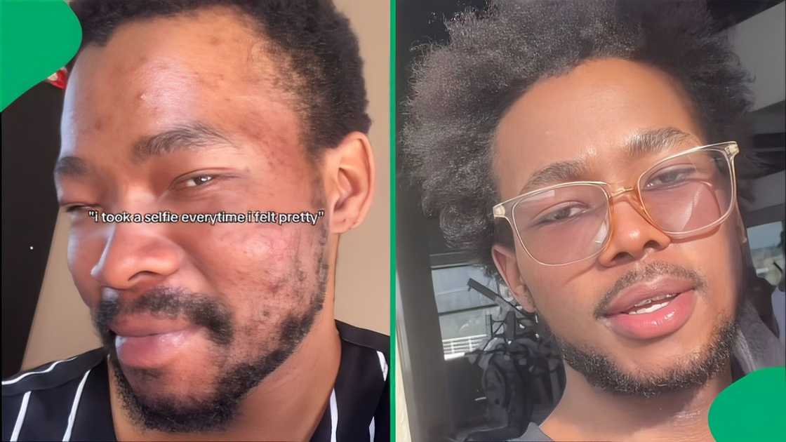 A man took to TikTok to showcase his skin glow-up, and people were shocked. A man took to TikTok to showcase his skin glow-up, and people were shocked.