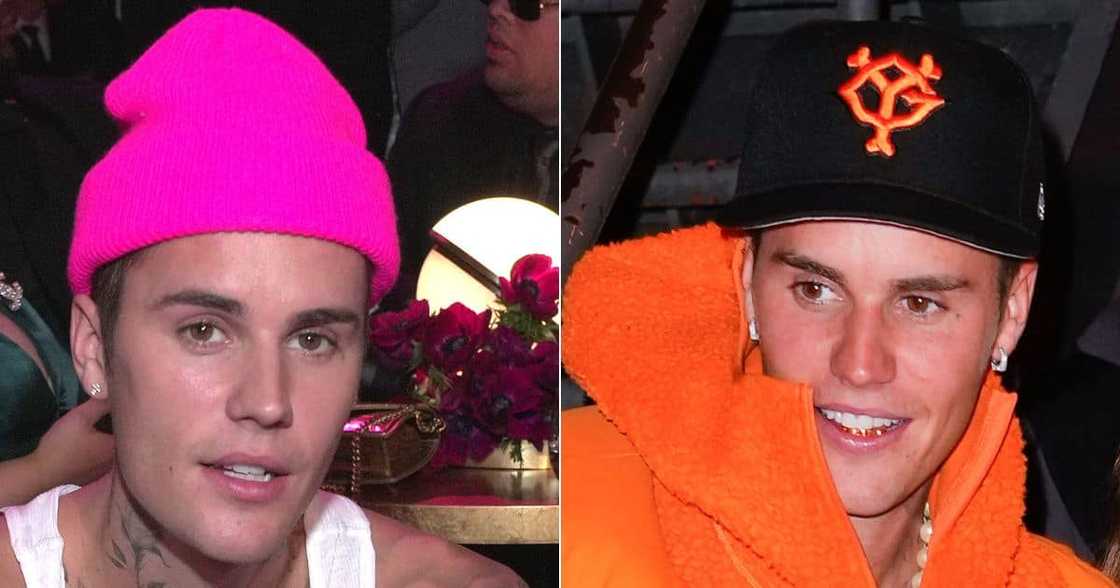 Justin Bieber, pop star, singer, musician, Ramsay Hunt Syndrome, Justin Bieber facial paralysis, artist, grammy winning artist, 'Justice' World Tour Justin Bieber, pop star, singer, musician, Ramsay Hunt Syndrome, Justin Bieber facial paralysis, artist, grammy winning artist, 'Justice' World Tour