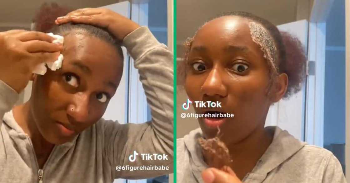 A woman's edges fell off after using perm A woman's edges fell off after using perm